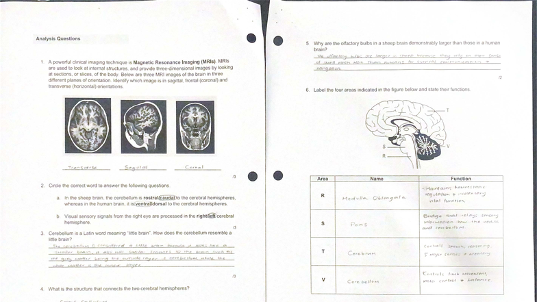Lab 1: Brain and Spinal Cord Research - MS Course Code - Studocu