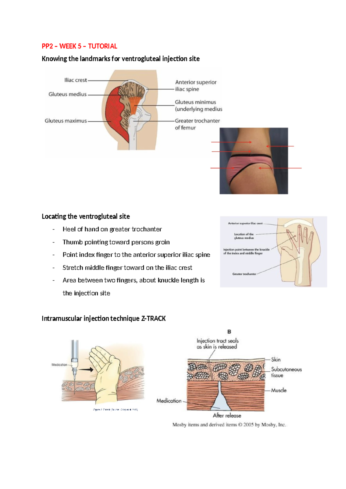 PP2 W5 - Ventrogluteal Injection Techniques and Practice Points - Studocu