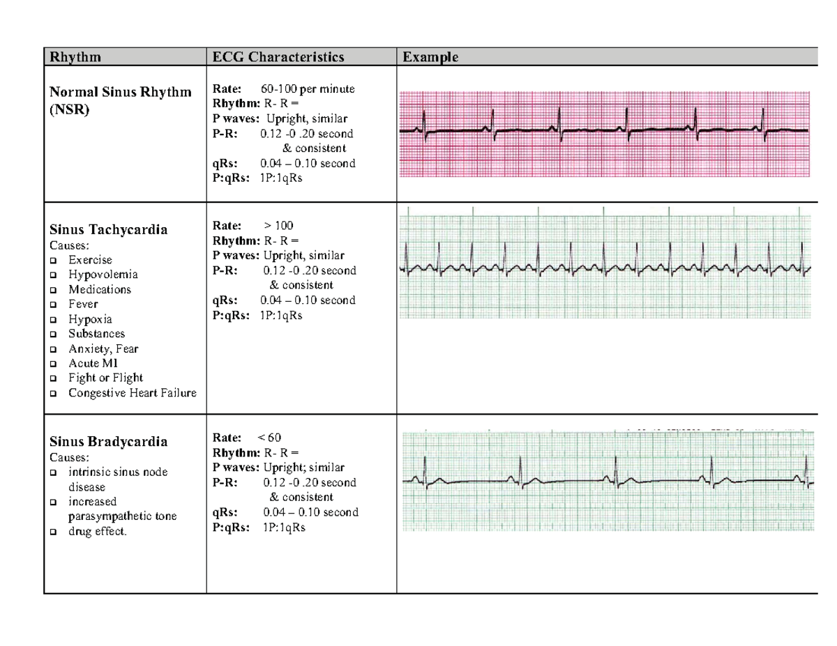 EKG Interpretation Sheet: Sinus and Atrial Rhythms Analysis - Studocu