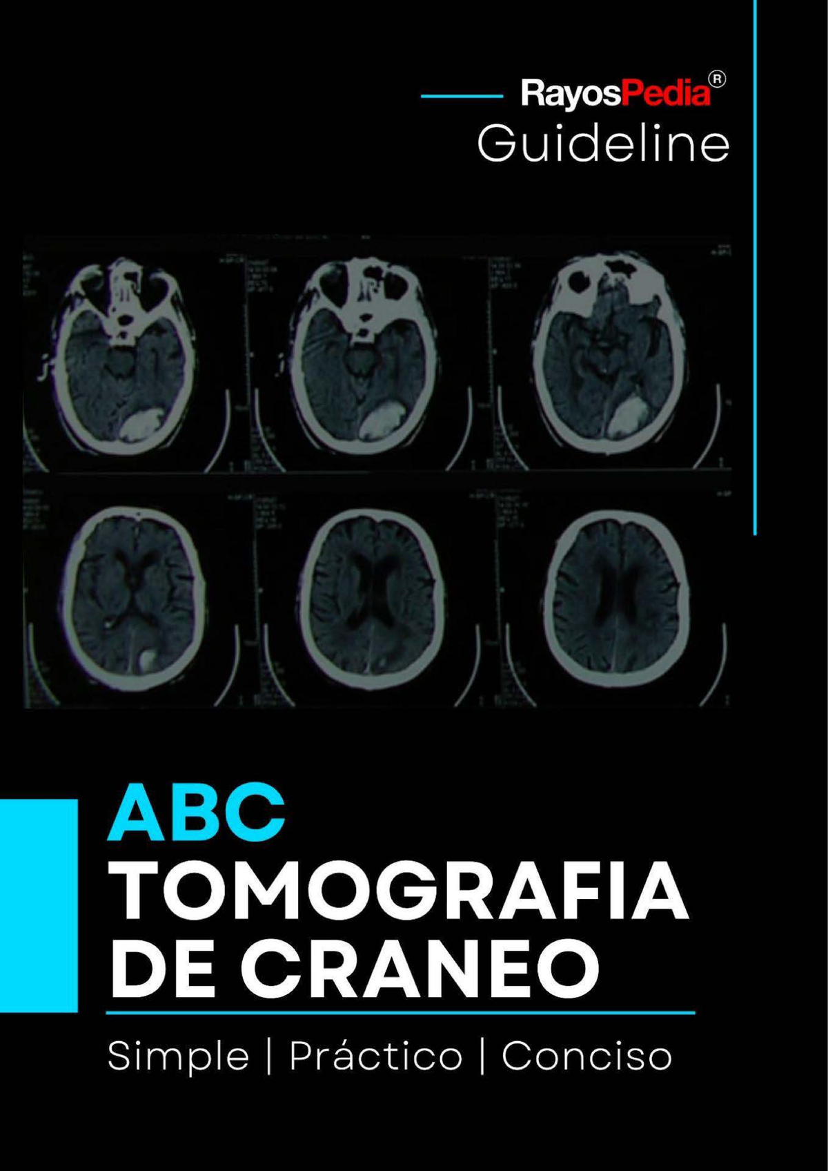 ABC de la Tomografía de Cráneo - Dr. Lorenz Rodríguez (5378) - Document Preview