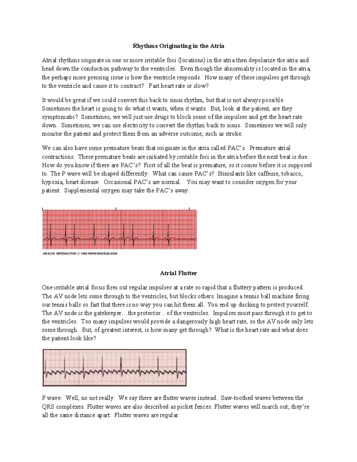 Atrial Dysrhythmias: Insights on Flutter & Fibrillation (NUR 301) - Studocu