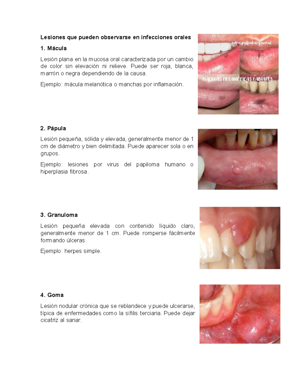 what is melanotan 1 Evaluación de Lesiones en Infecciones Orales - Actividad 6