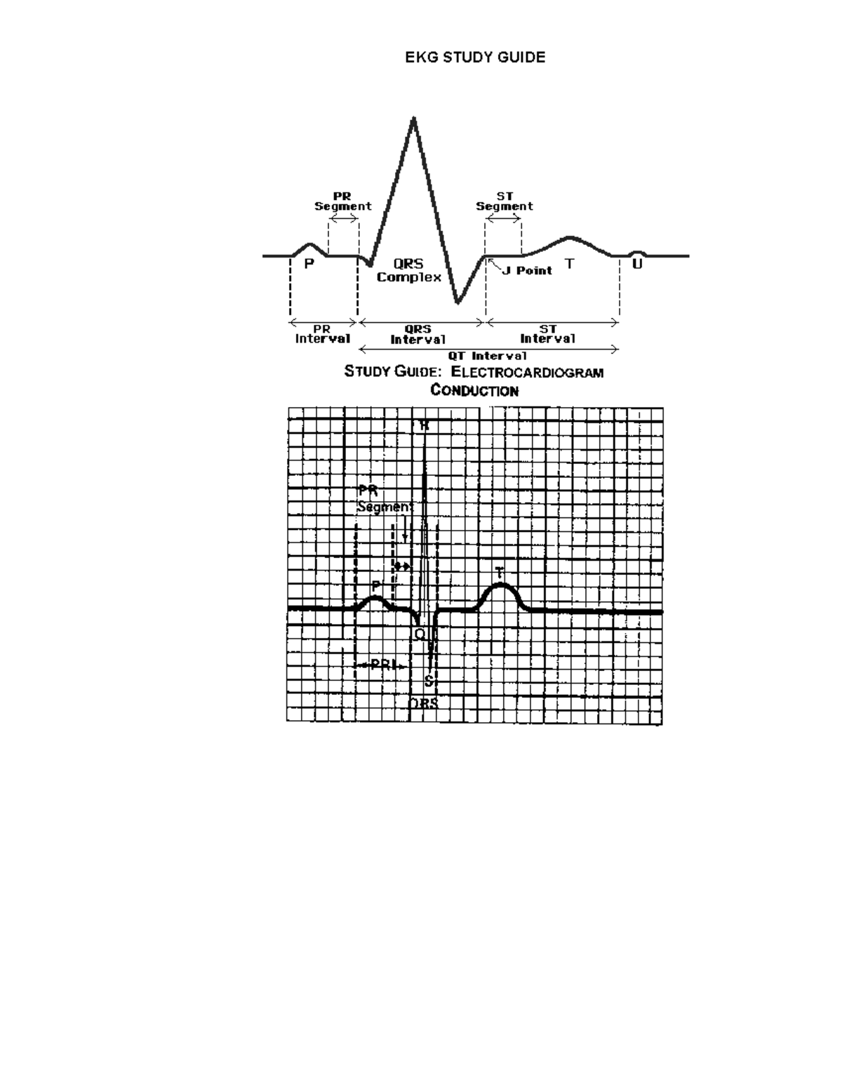 EKG Study Guide - Lecture notes EKG Lab Week 2 - EKG STUDY GUIDE STUDY ...