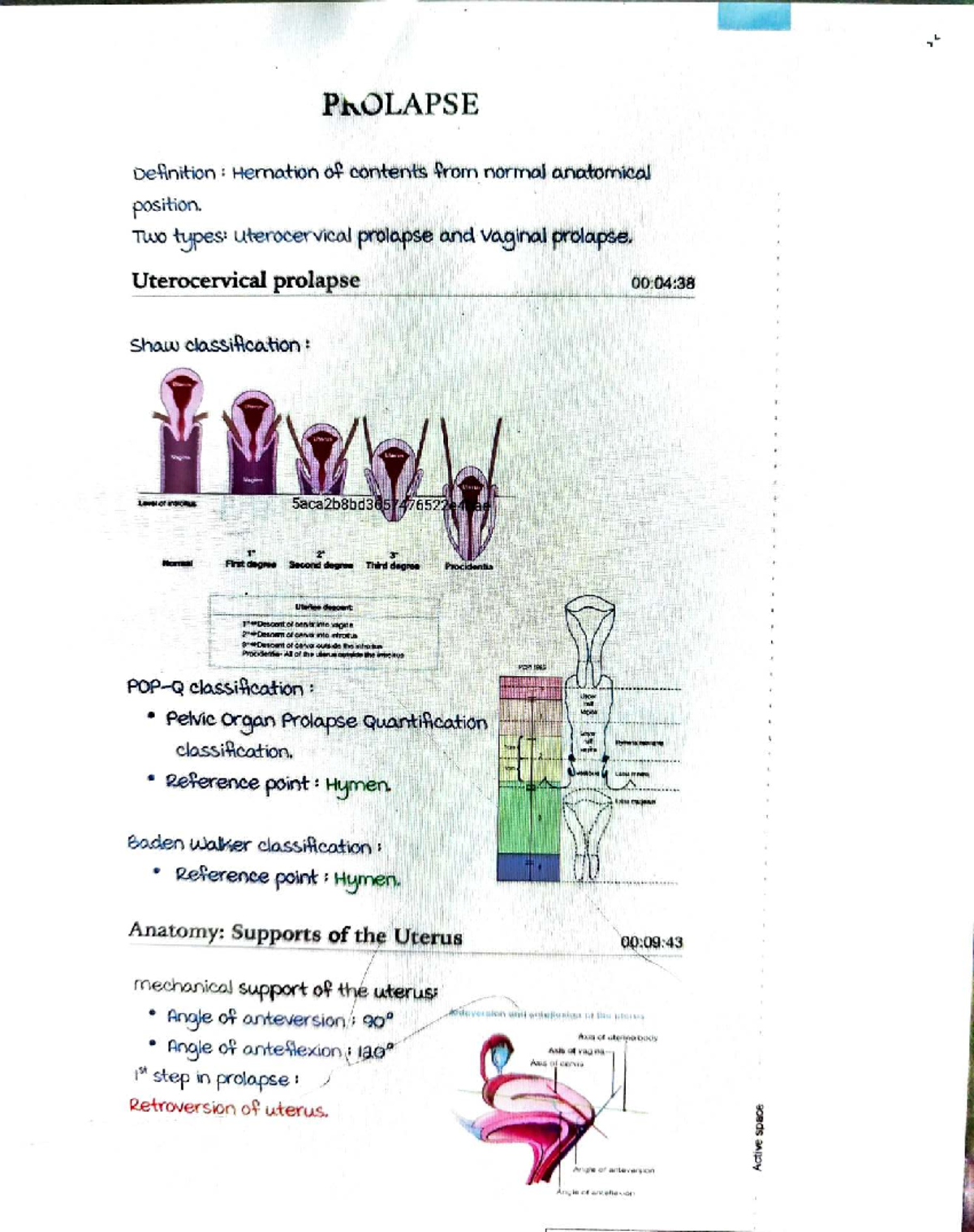 Prolapse Management: Understanding Uterocervical & Vaginal Prolapse ...