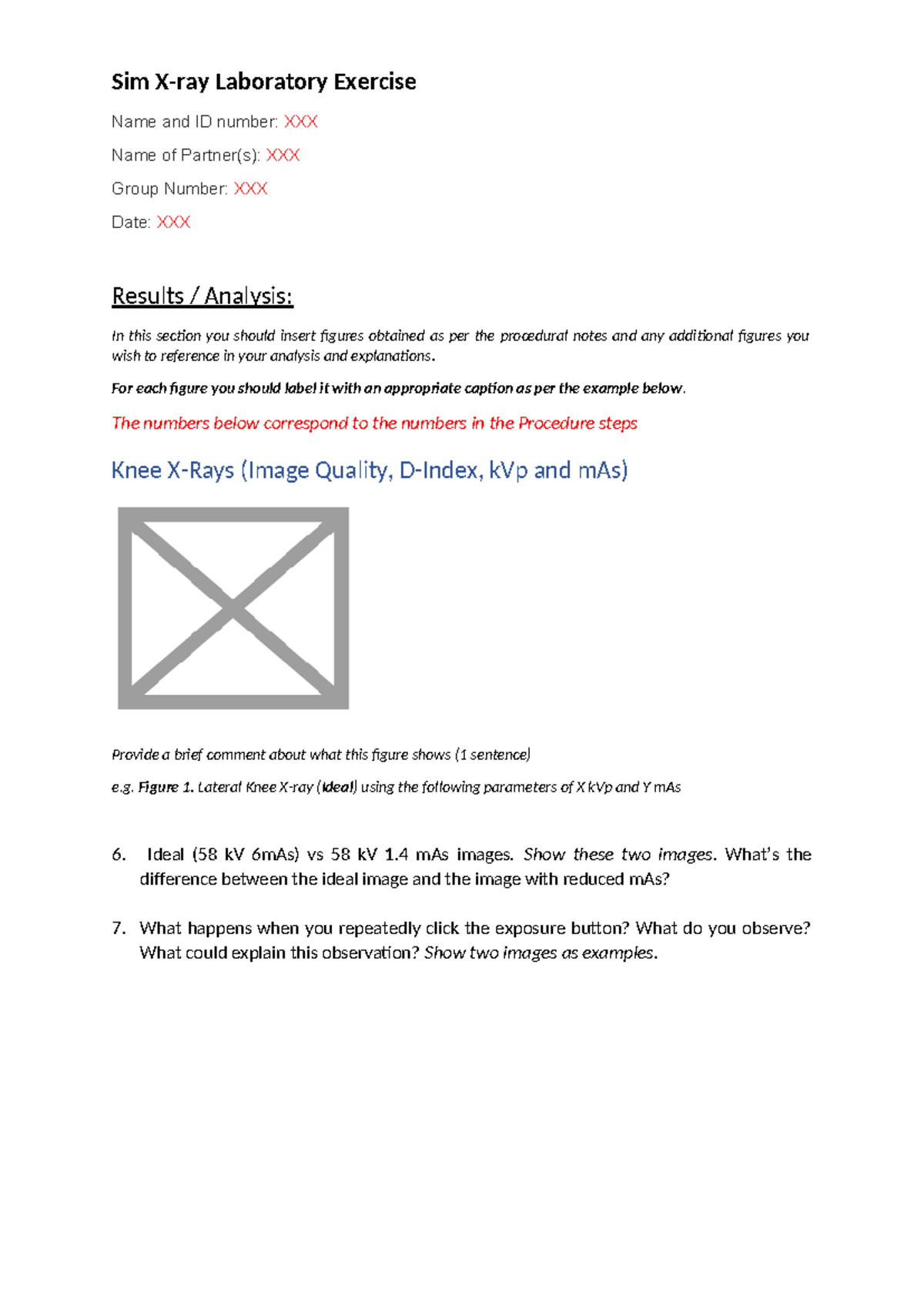Sim Xray Lab Logbook (Course Code: SIM 101) - Results & Analysis - Studocu
