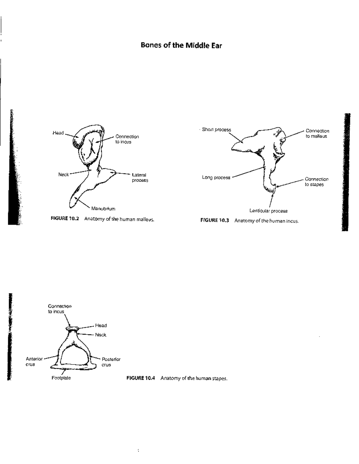 Anatomy of the Middle Ear: Malleus, Incus, and Stapes Insights - Studocu