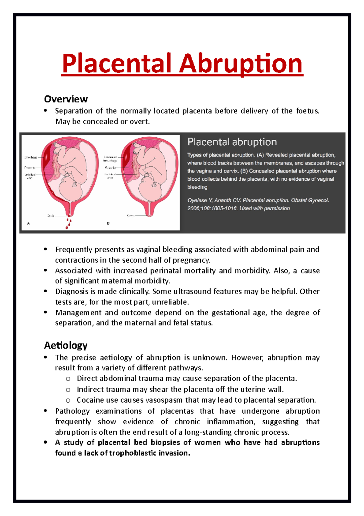 Placental Abruption Causes