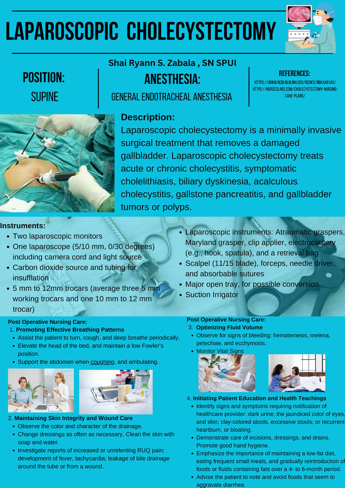 Laparoscopic Cholecystectomy Procedure Overview & Post-Op Care Guide ...