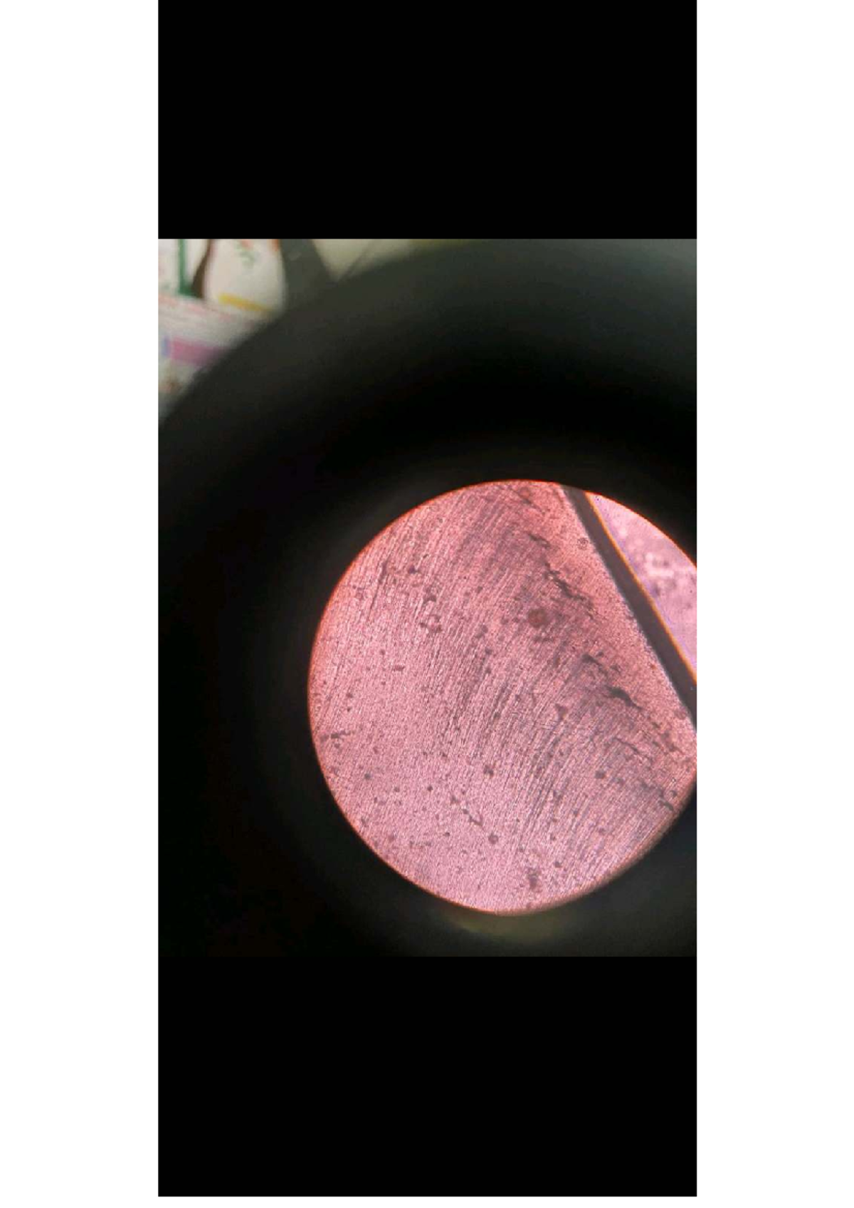 DADH Slides -1: Interglobular Diffuse Calcification Overview - Studocu