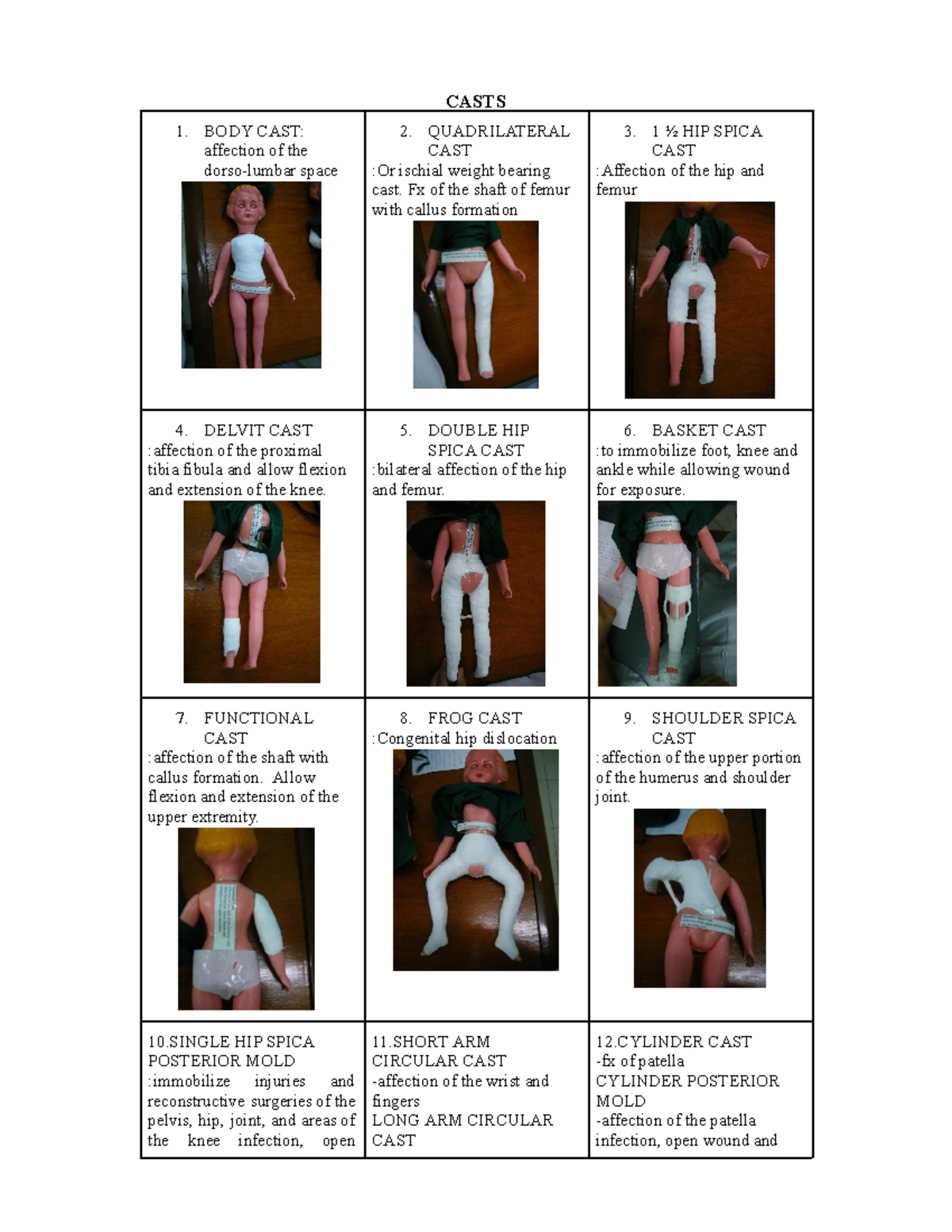 Casts and Tractions in Orthopedics: An Overview of Techniques - Studocu