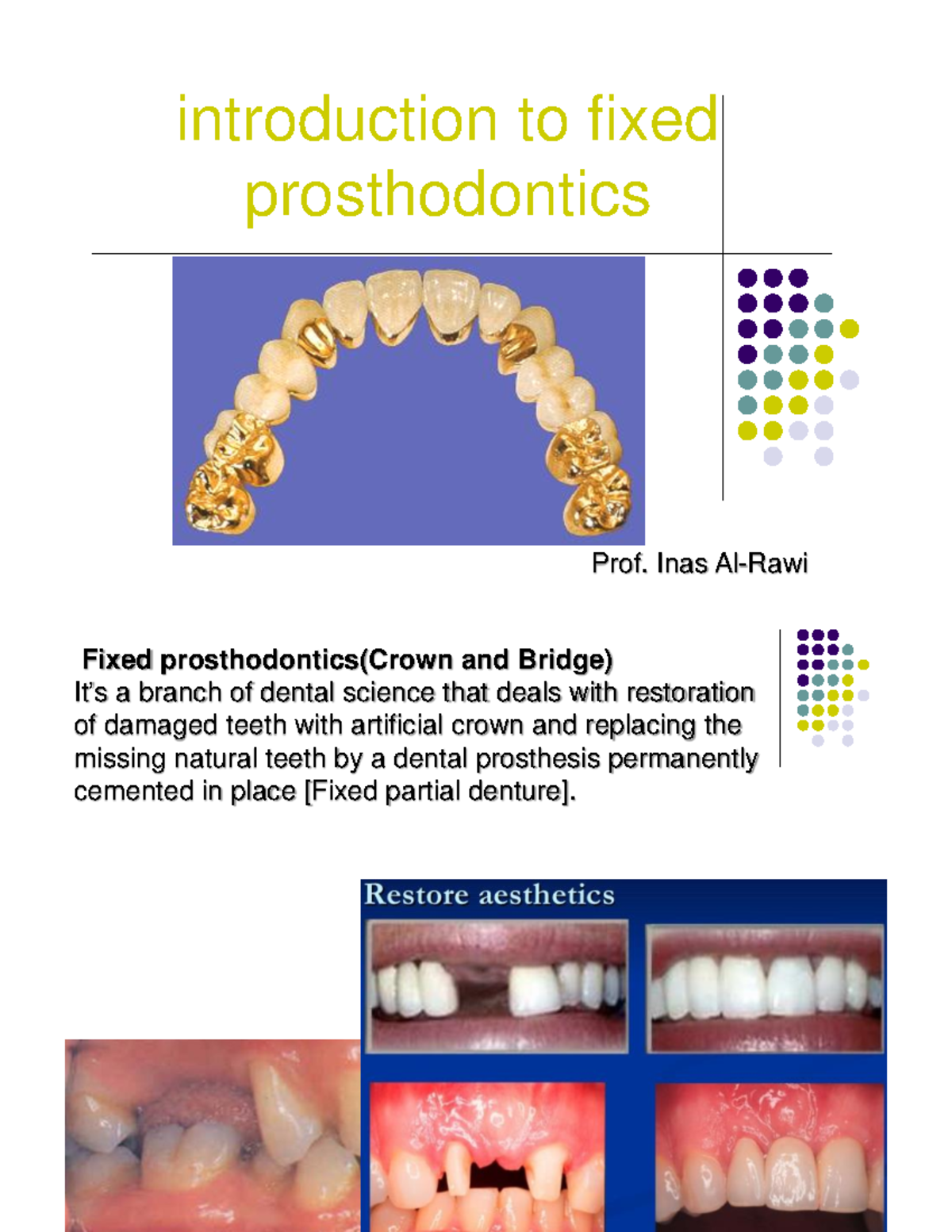 Introduction to Fixed Prosthodontics: Crown and Bridge Overview - Studocu