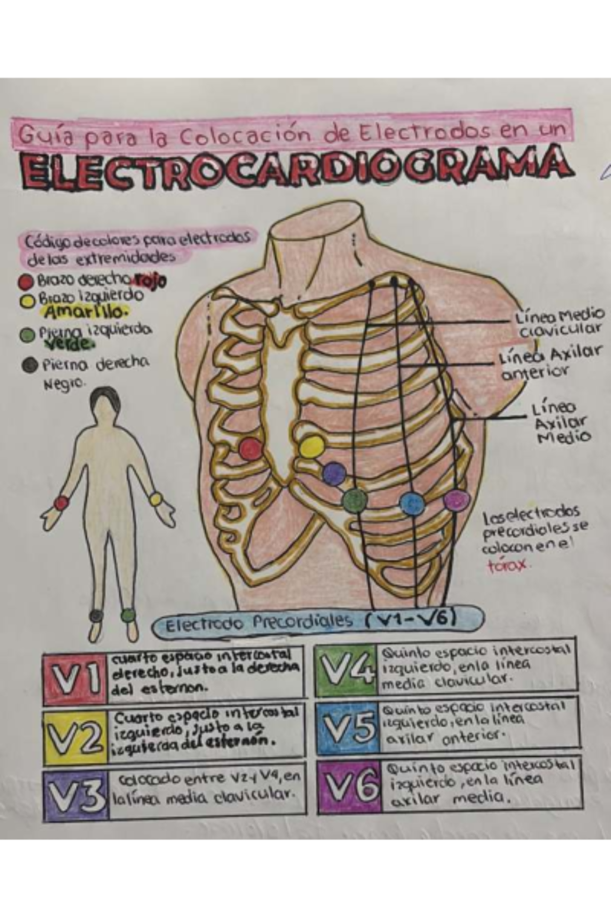 ELECTROCARDIOGRAMA: Guía de Colocación de Electrodos en Color - Studocu
