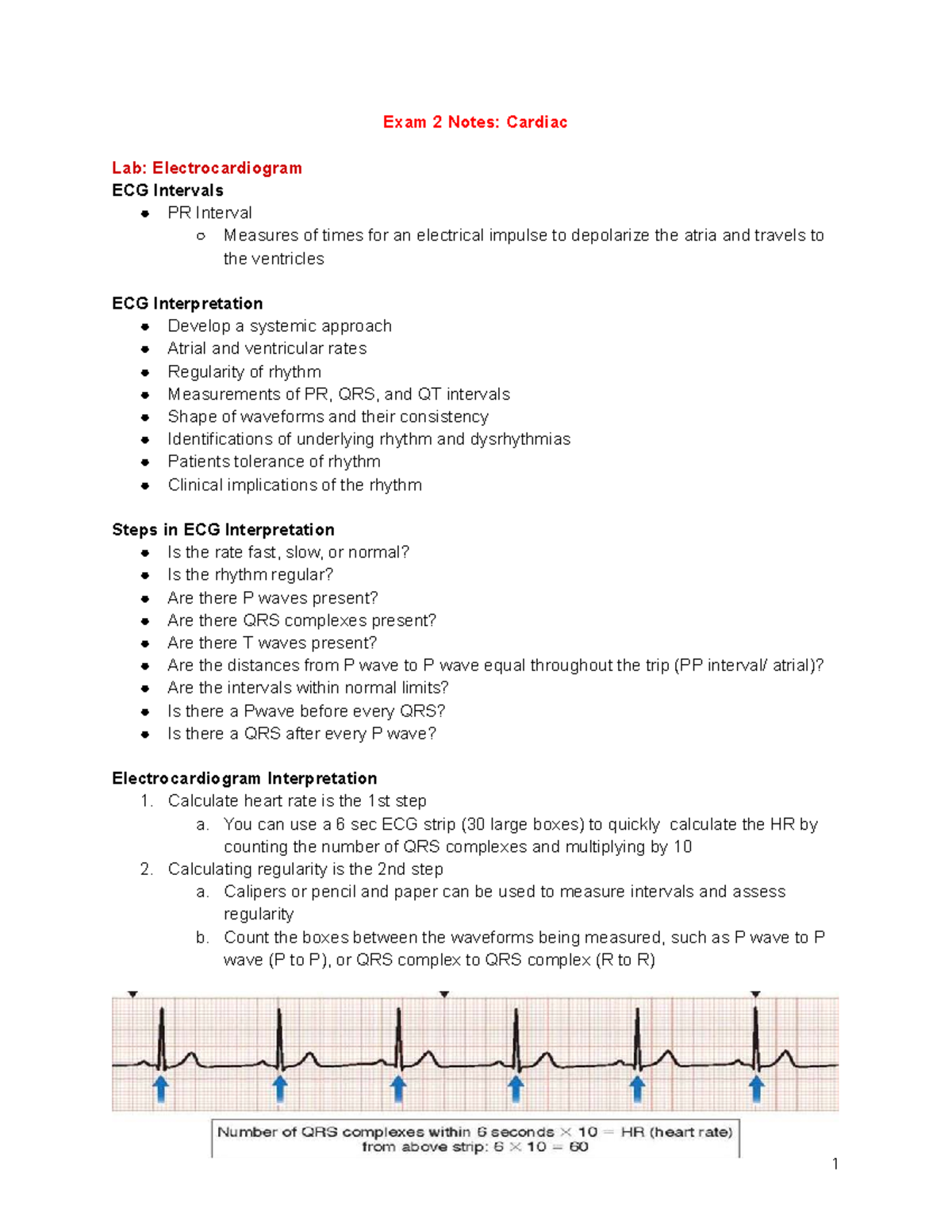 NUR 445 - Exam 2 Notes: ECG Interpretation and Cardiac Dysrhythmias ...