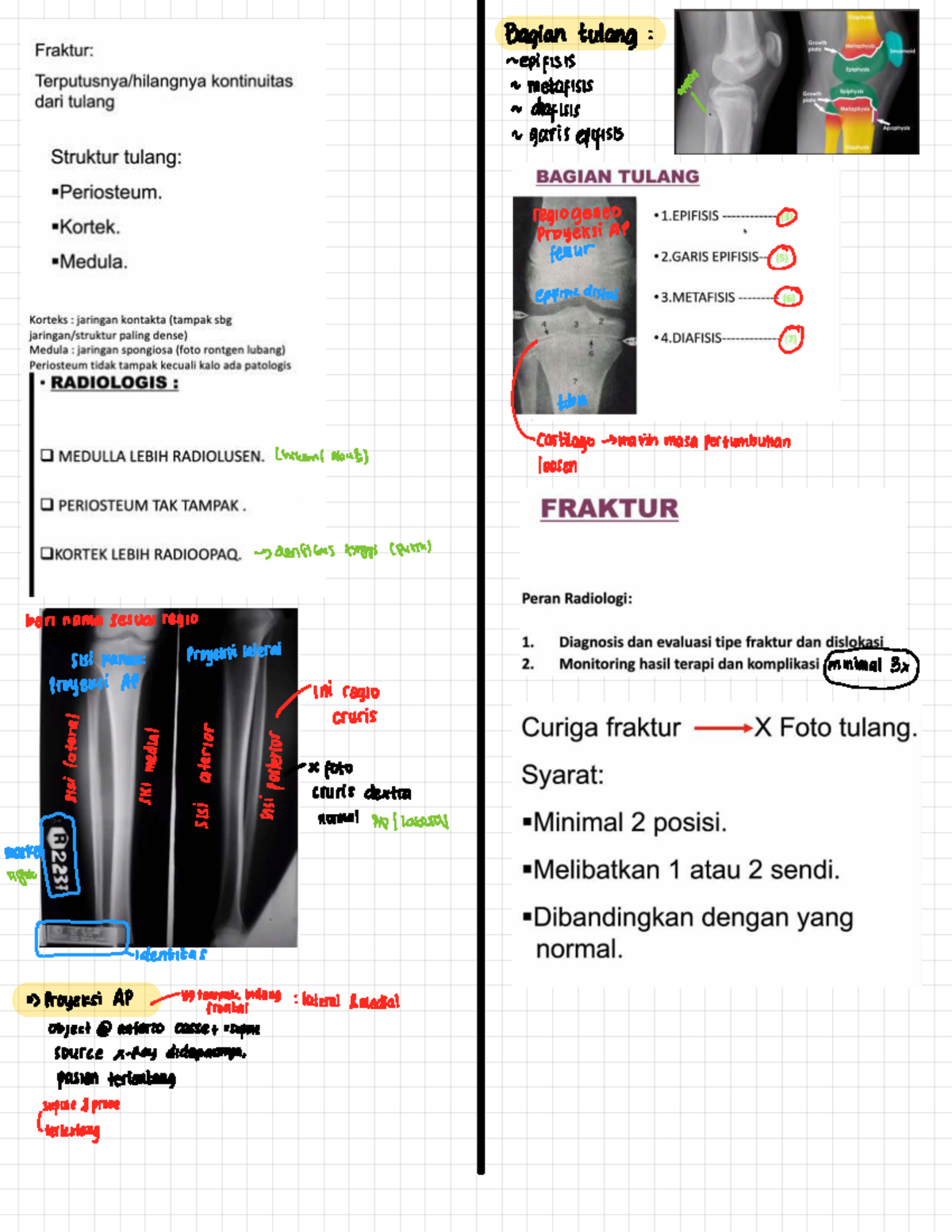 Radiology Notes: Proyeksi AP & Lateral pada Fraktur (RADI 101) - Studocu