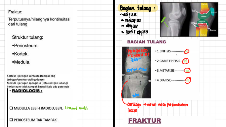 Radiology Notes: Proyeksi AP & Lateral pada Fraktur (RADI 101) - Studocu