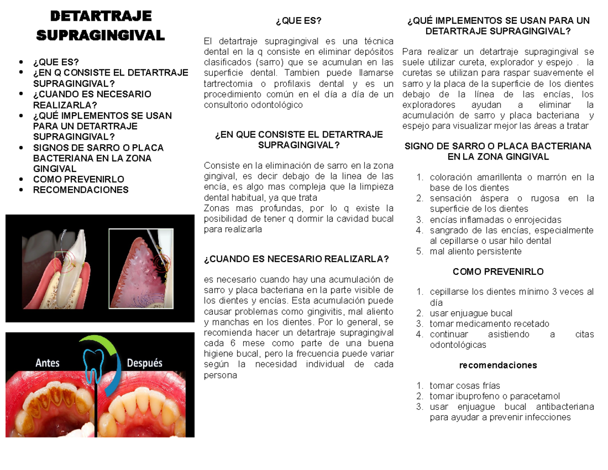 Guía Completa sobre el Detartraje Supragingival: Importancia y ...