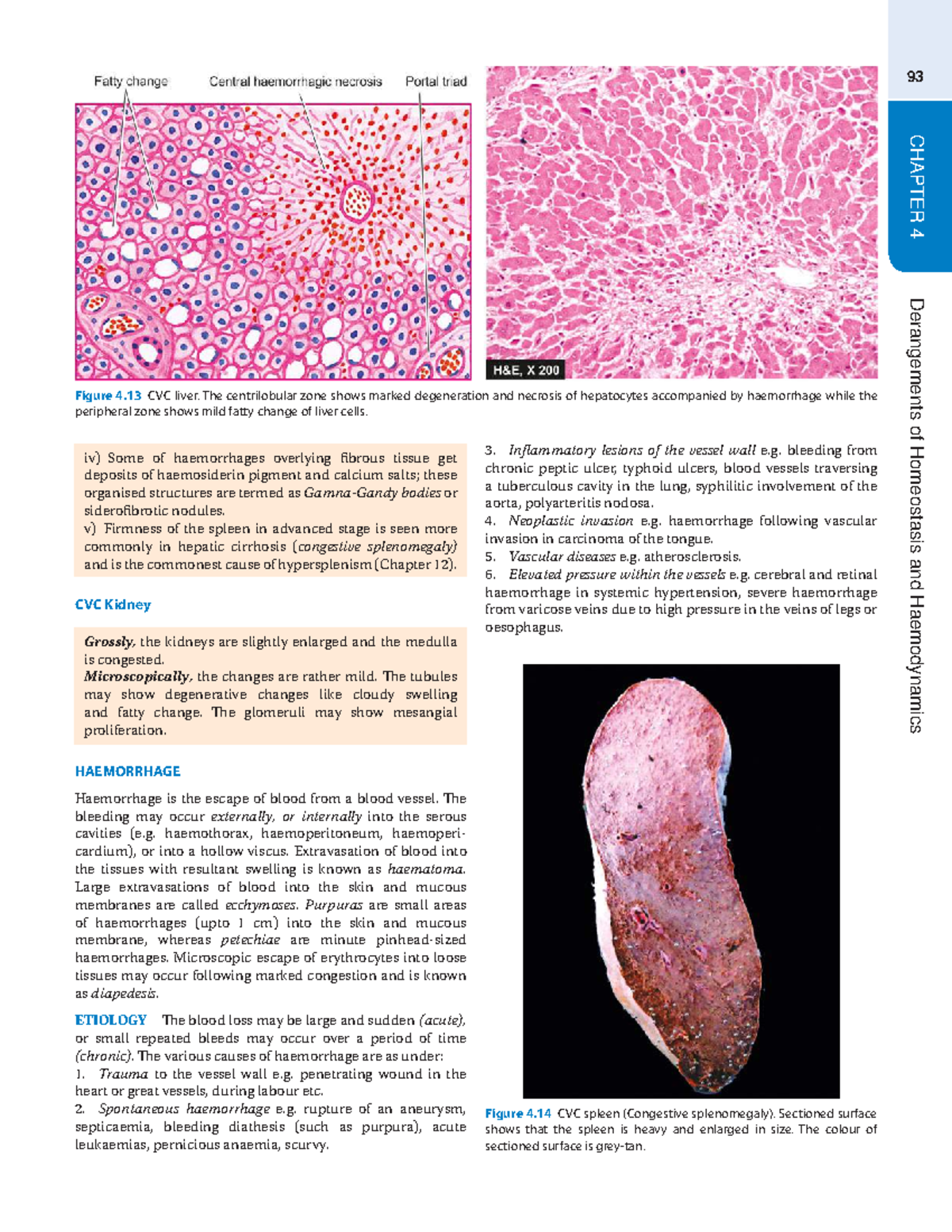 Pathology Insights: Homeostasis, Haemodynamics & Shock (HMP-013) - Studocu