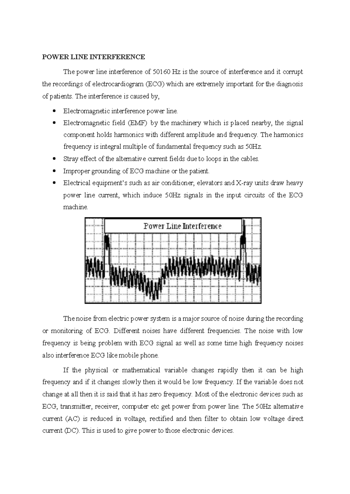 Power Line Interference and Right Leg Driven ECG Amplifier Analysis ...