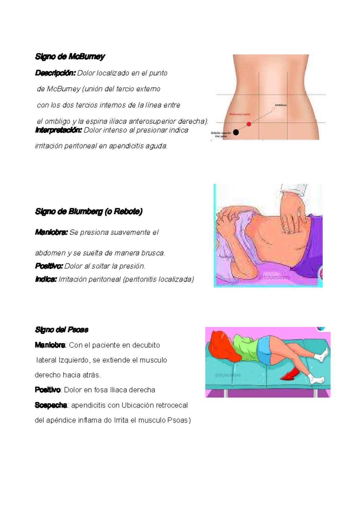 Maniobras y Signos de Apendicitis: Diagnóstico Clínico - Document Preview