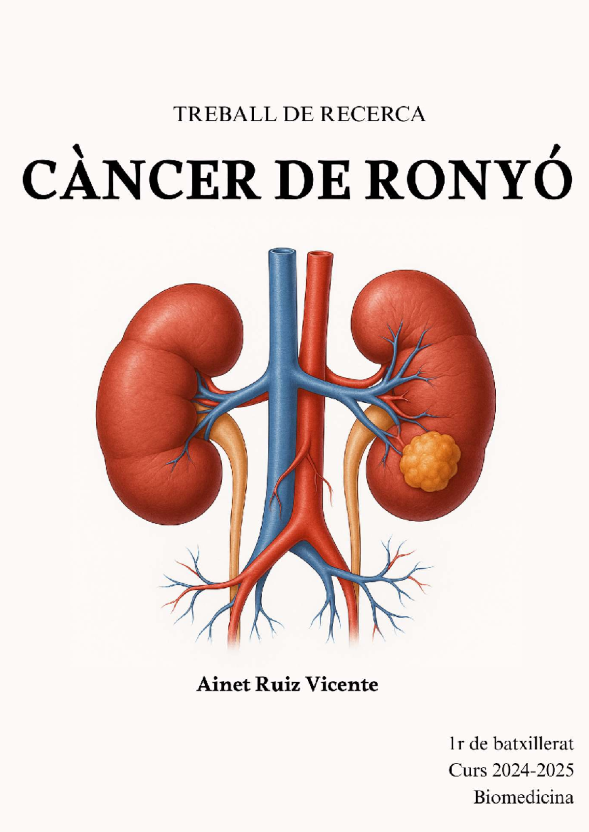 Càncer de Ronyó: Tipus, Diagnòstic i Tractaments (CÀNCER 101) - Studocu