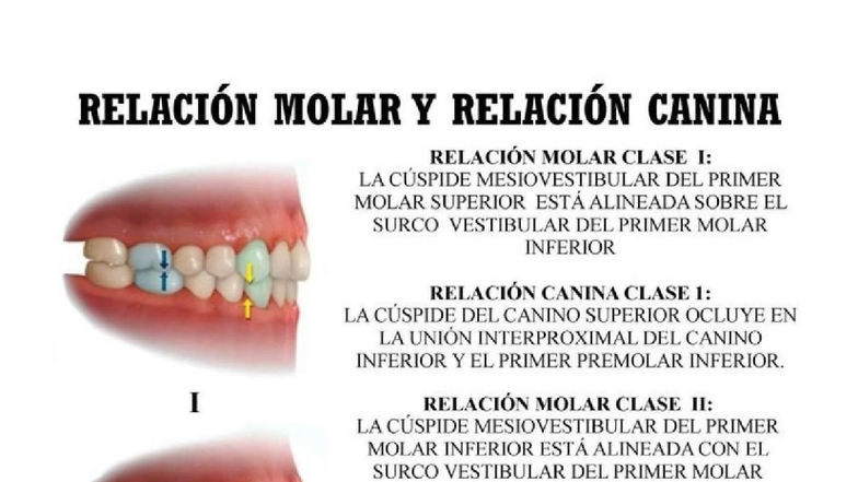 clasificaci-n-de-angle-en-ortodoncia-relaciones-molares-y-caninas