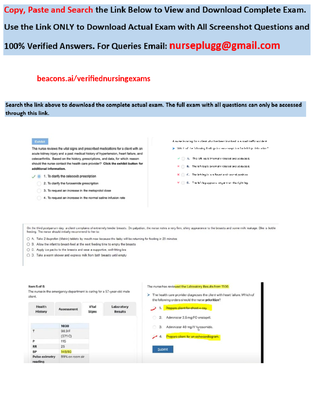2025 NCLEX-RN Exam Prep: 150 Questions & Answers for Success - Studocu