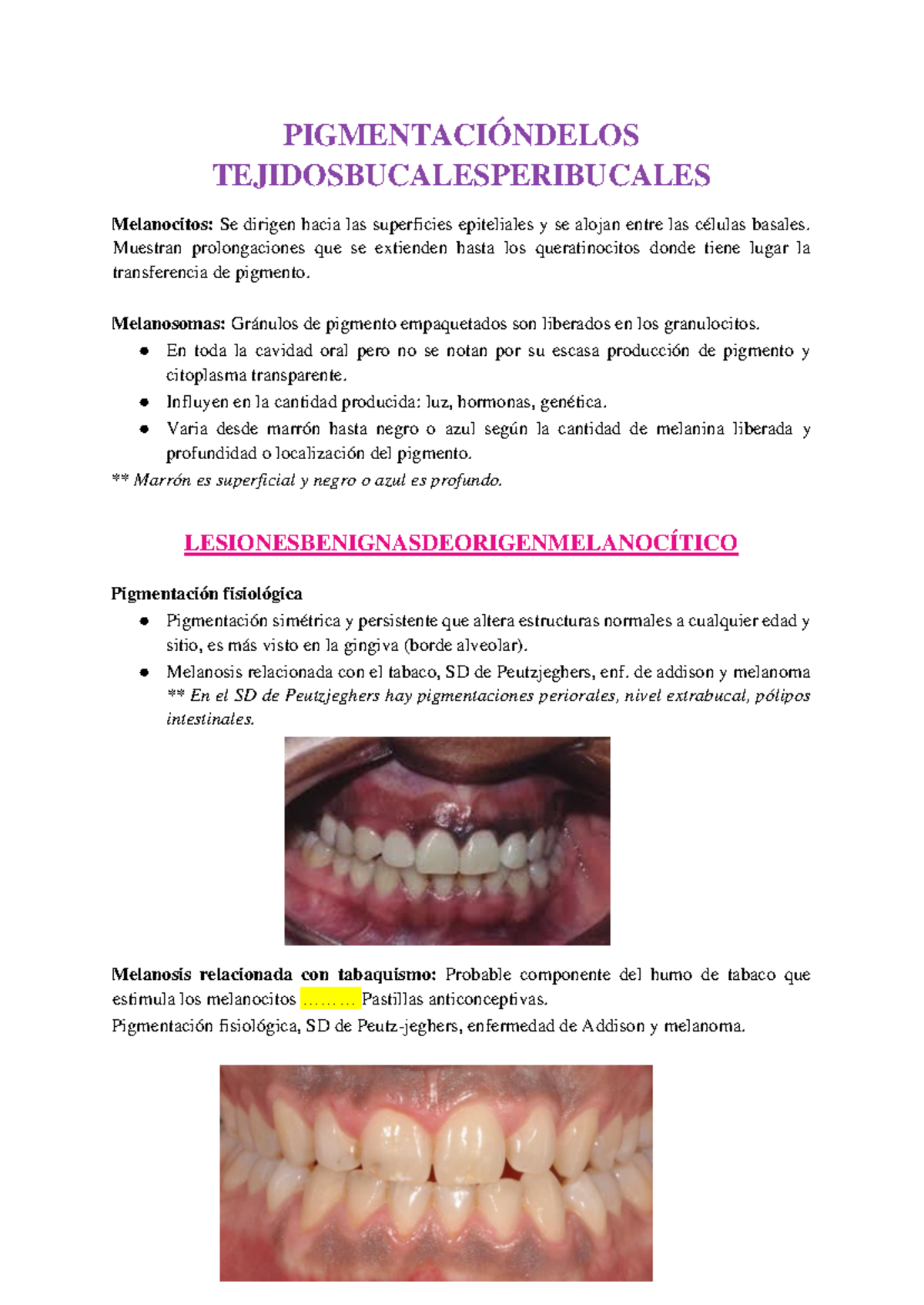 mcula melantica oral tratamiento Lesiones pigmentadas de la mucosa oral. Parte I Macula Melanotica En Boca |