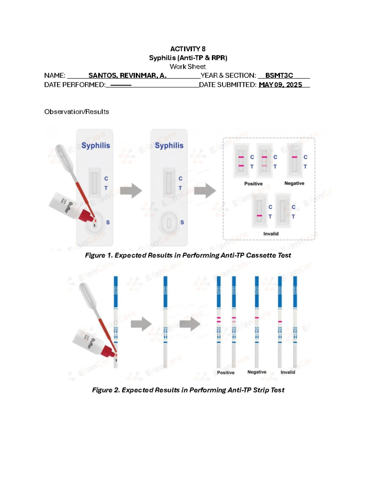 ACTIVITY 9: SLE Latex Agglutination Test Lab Worksheet (BSMT3C) - Studocu