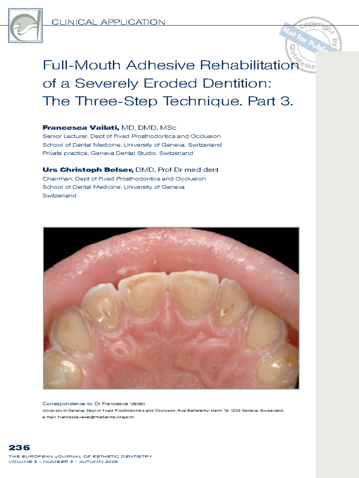 Clinical Application of Adhesive Rehabilitation Techniques for Severely ...