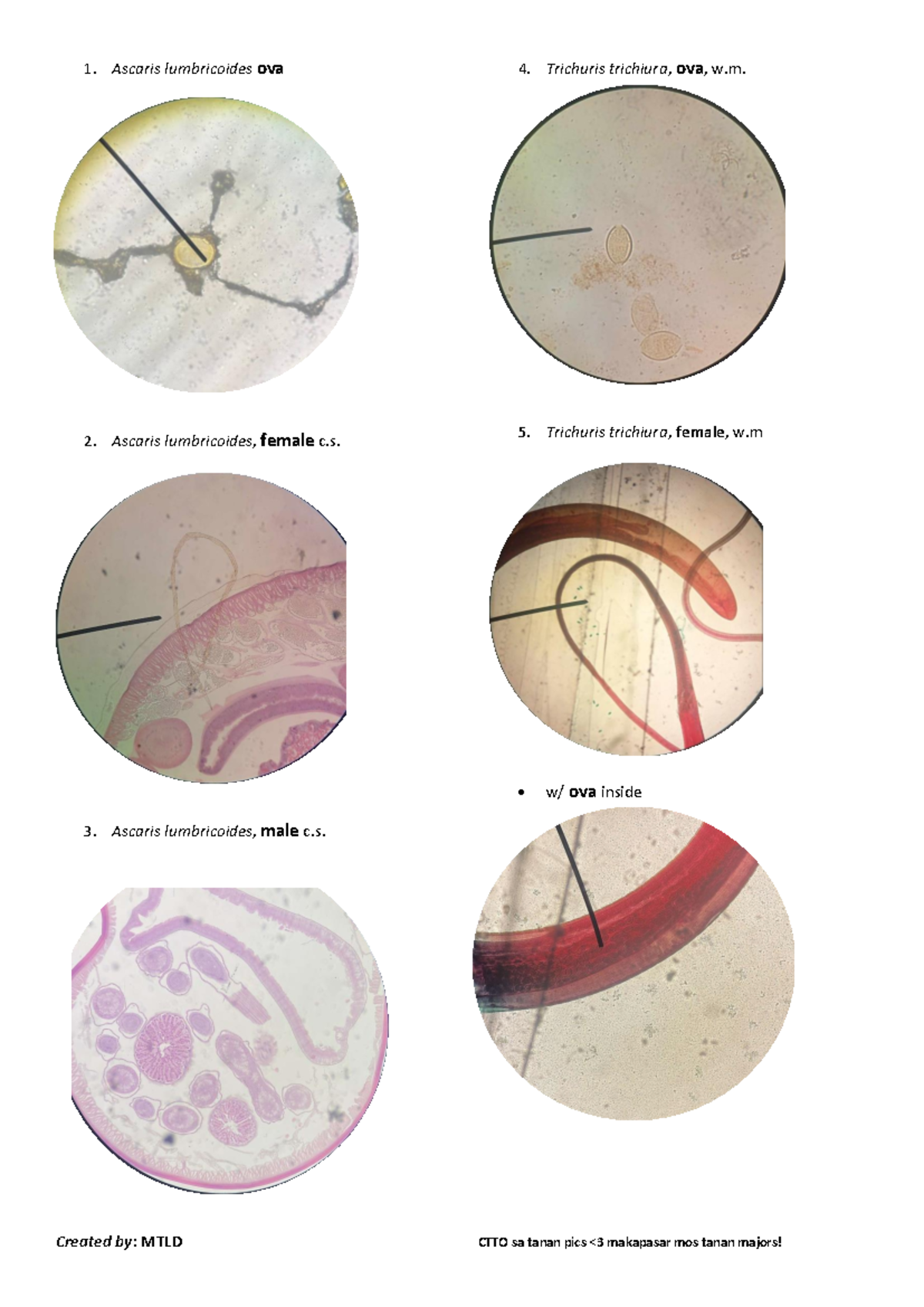 Para-lab-practicals - microcope - 1. Ascaris lumbricoides ova 2 ...