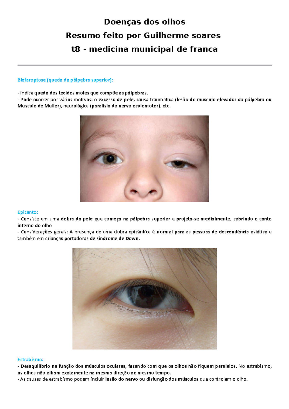 Doenças dos olhos by GUI Soares - Doenças dos olhos Resumo feito por