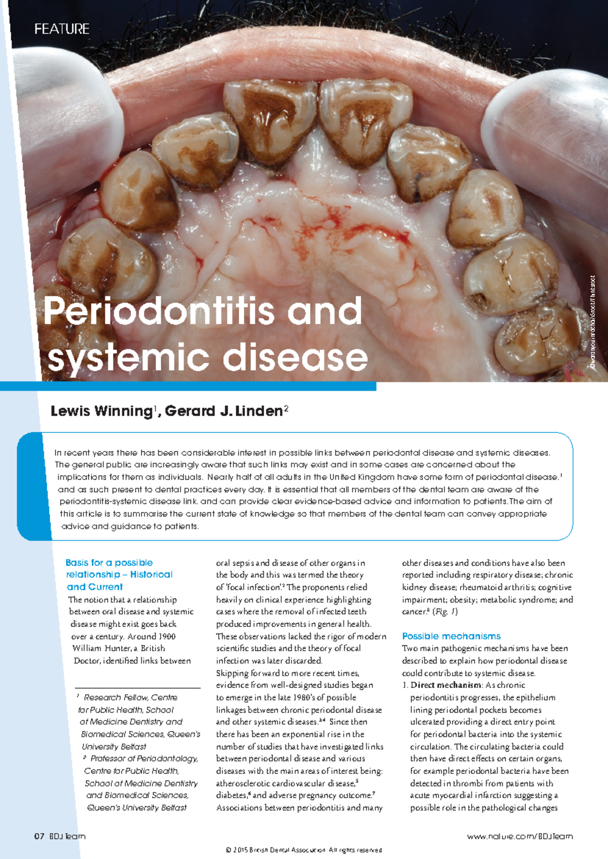 Periodontitis and systemic diseases - Periodontitis and systemic ...