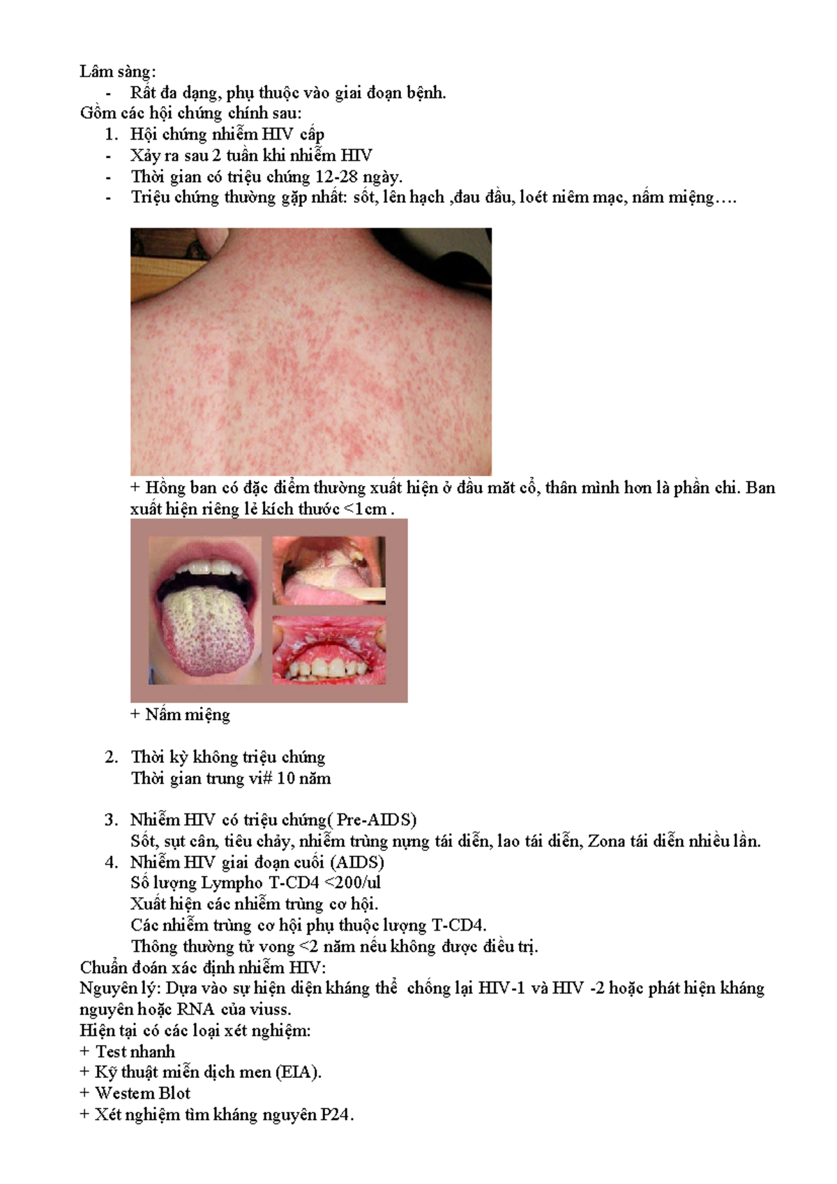 Lâm sàng HIV: Các Giai Đoạn và Triệu Chứng Chính - Studocu