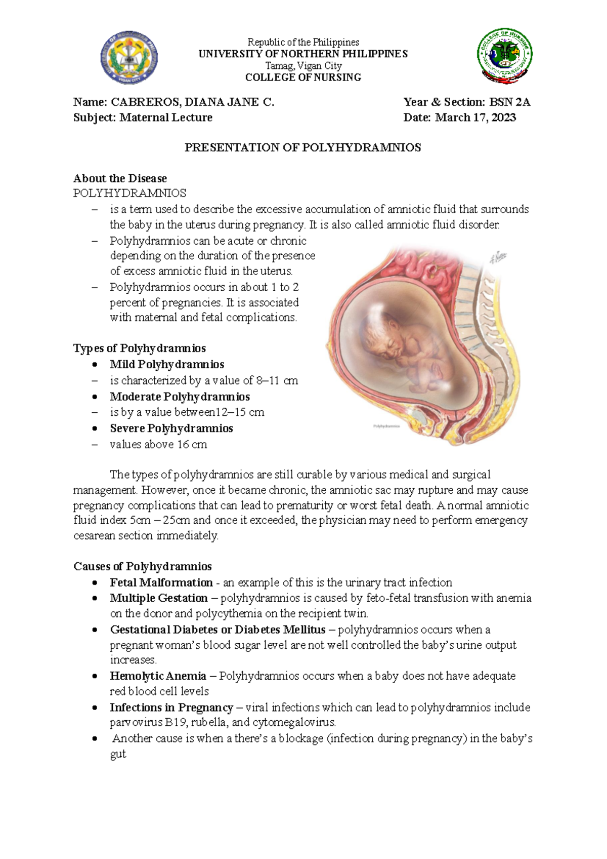   Polyhydramnios   Republic of the Philippines UNIVERSITY OF ...