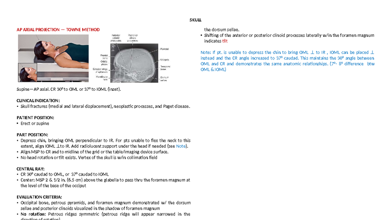Skull - Lecture Notes on AP Axial Projection (Towne Method) - Studocu