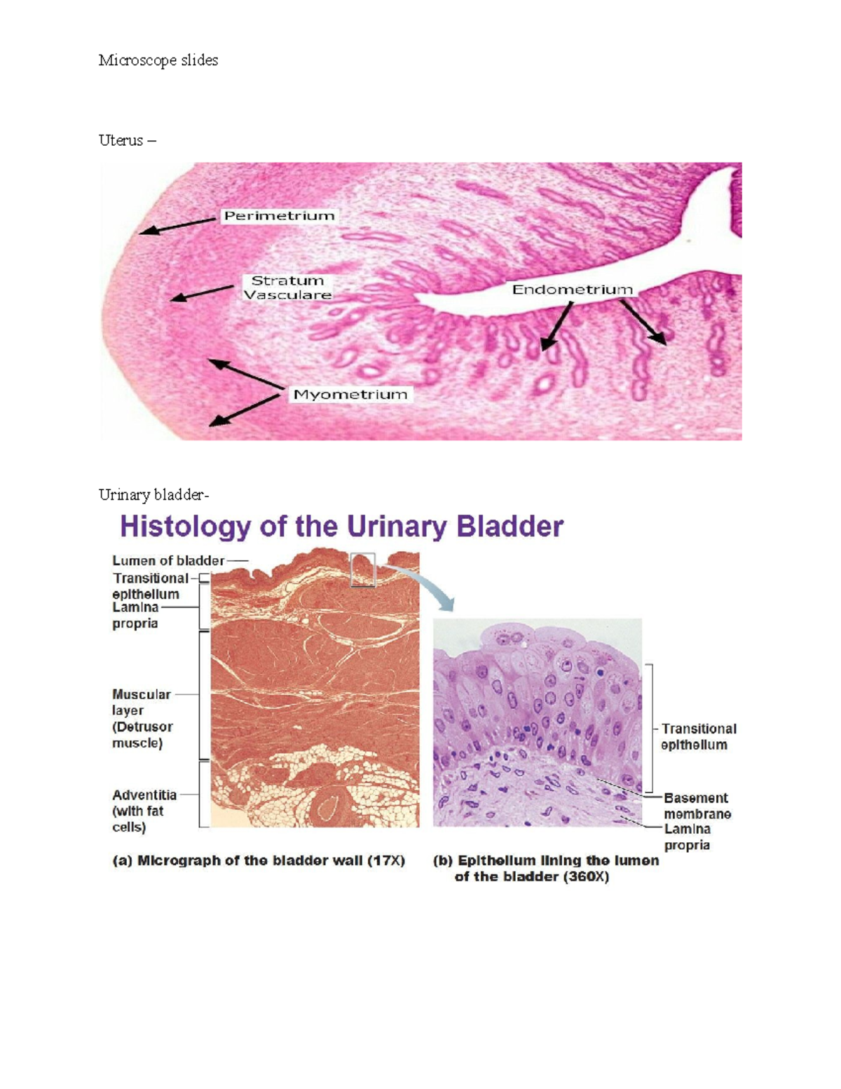 Labeled ddiagram for micrscopic image' - BP 723 - Uterus – Urinary ...