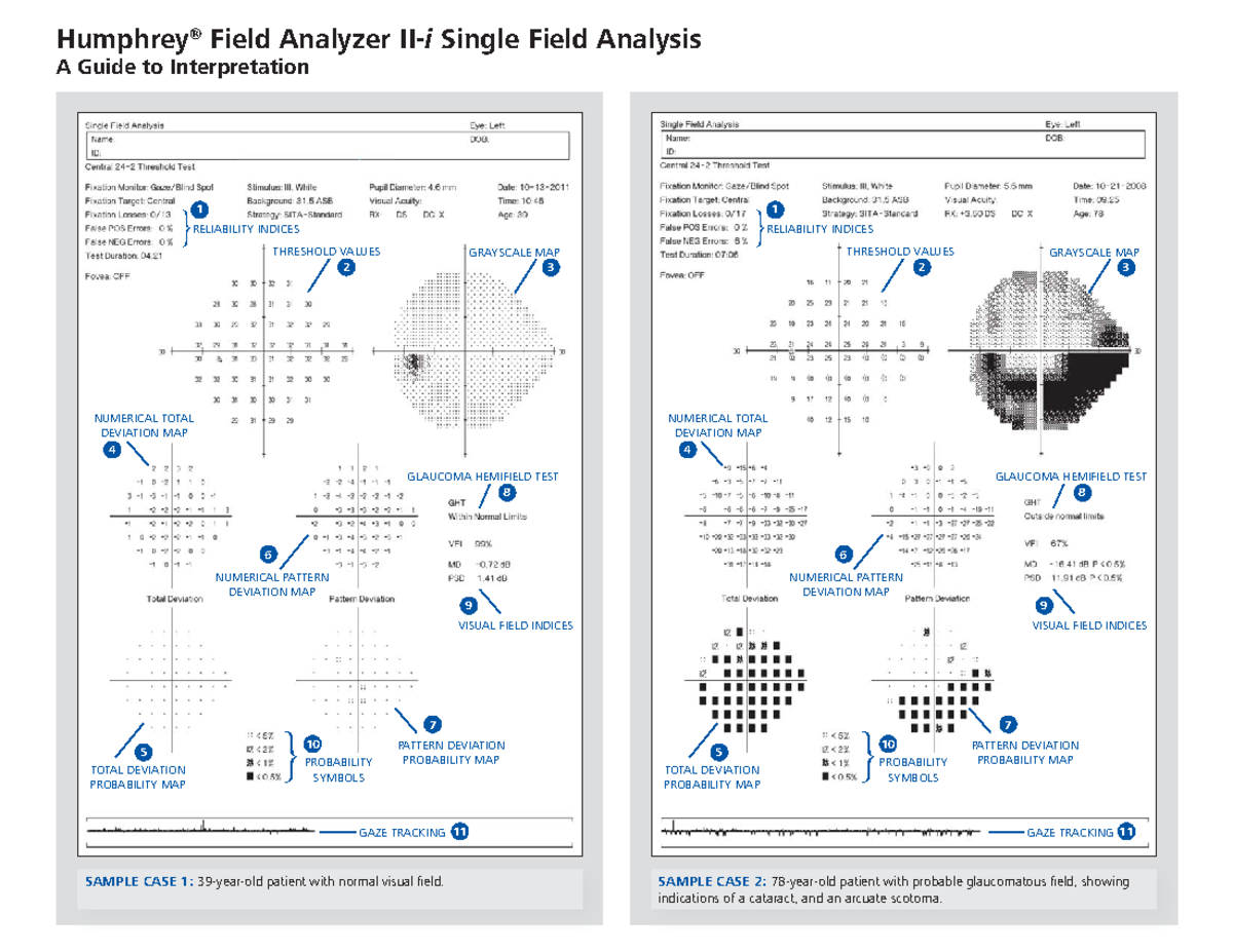 HFA5268 SEC: Guide to Interpreting HFA II-i Single Field Analysis - Studocu