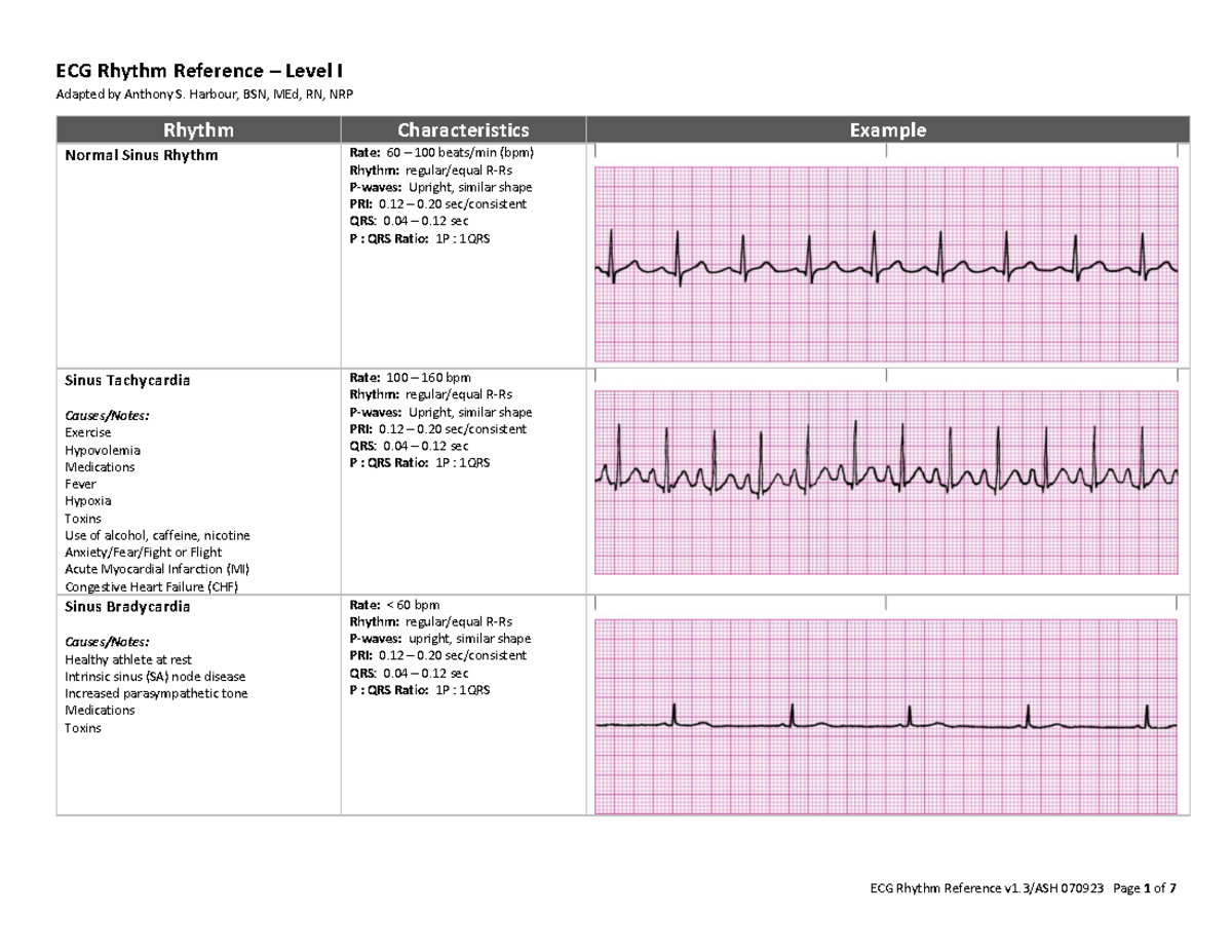 ECG Rhythm Reference v1-3 rev 070923 - ECG Rhythm Reference – Level I ...