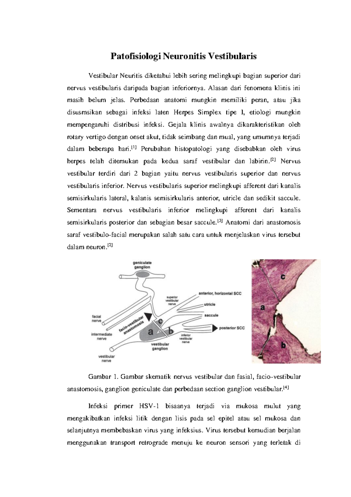Patofisiologi Neuronitis Vestibularis: Analisis dan Temuan Terbaru ...