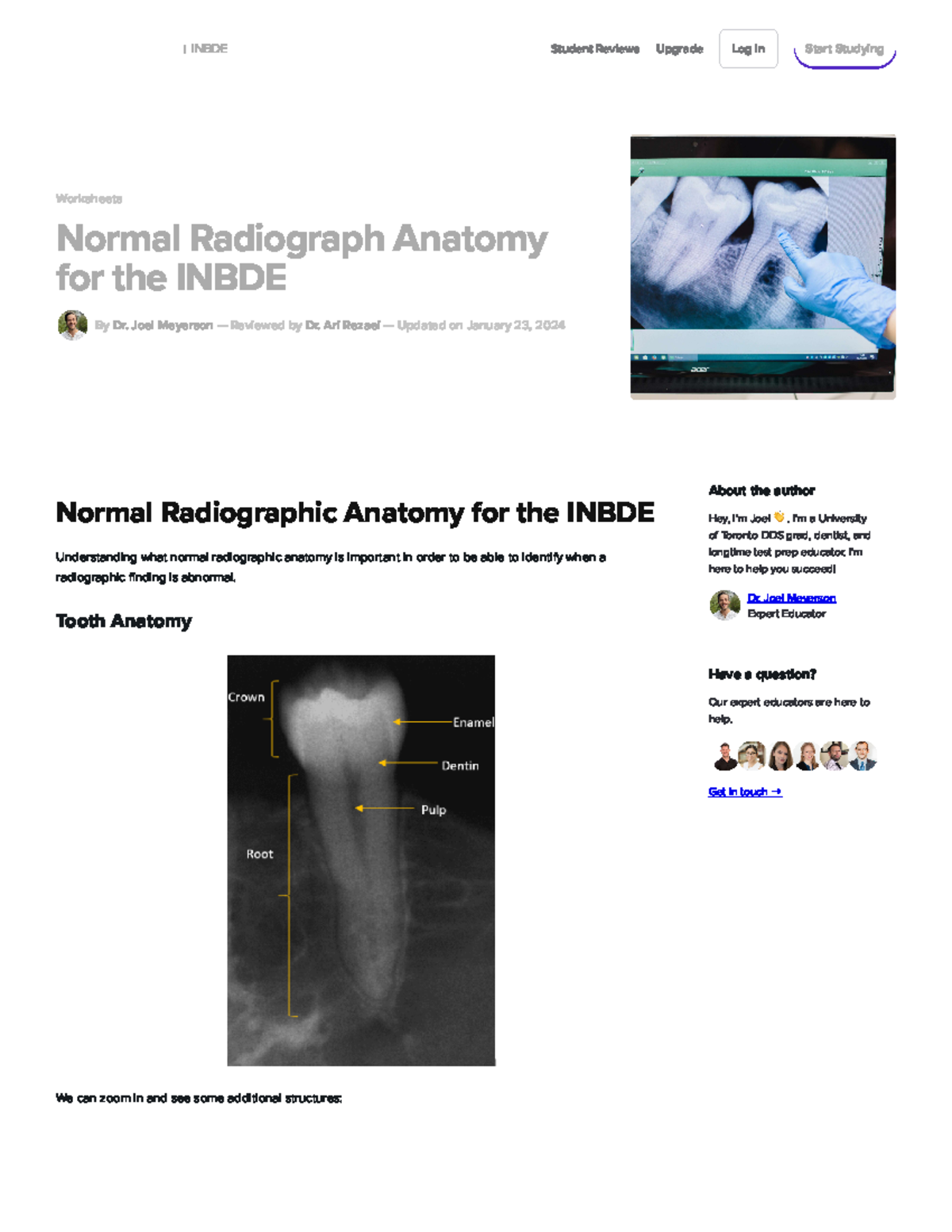 Normal Radiograph Anatomy for the Inbde Inbde Bootcamp - Worksheets ...