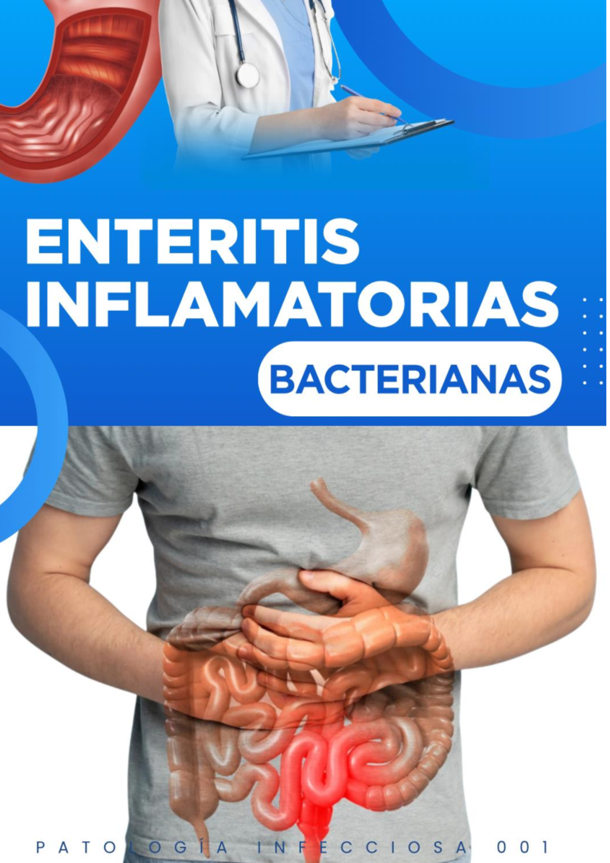 Enteritis Inflamatorias Bacterianas - Capítulo 101 (Trabajo Final ...