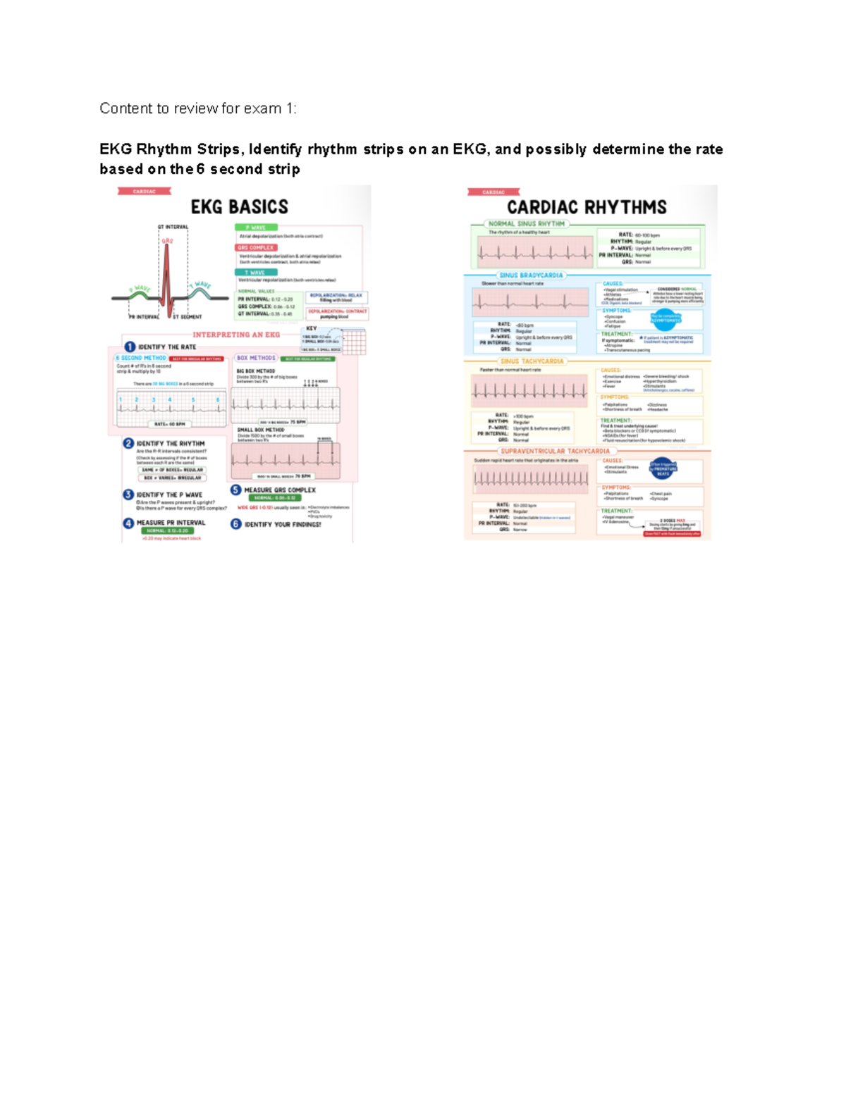 EKG Rhythm Strips and Cardiac Interventions Study Guide (Nursing ...