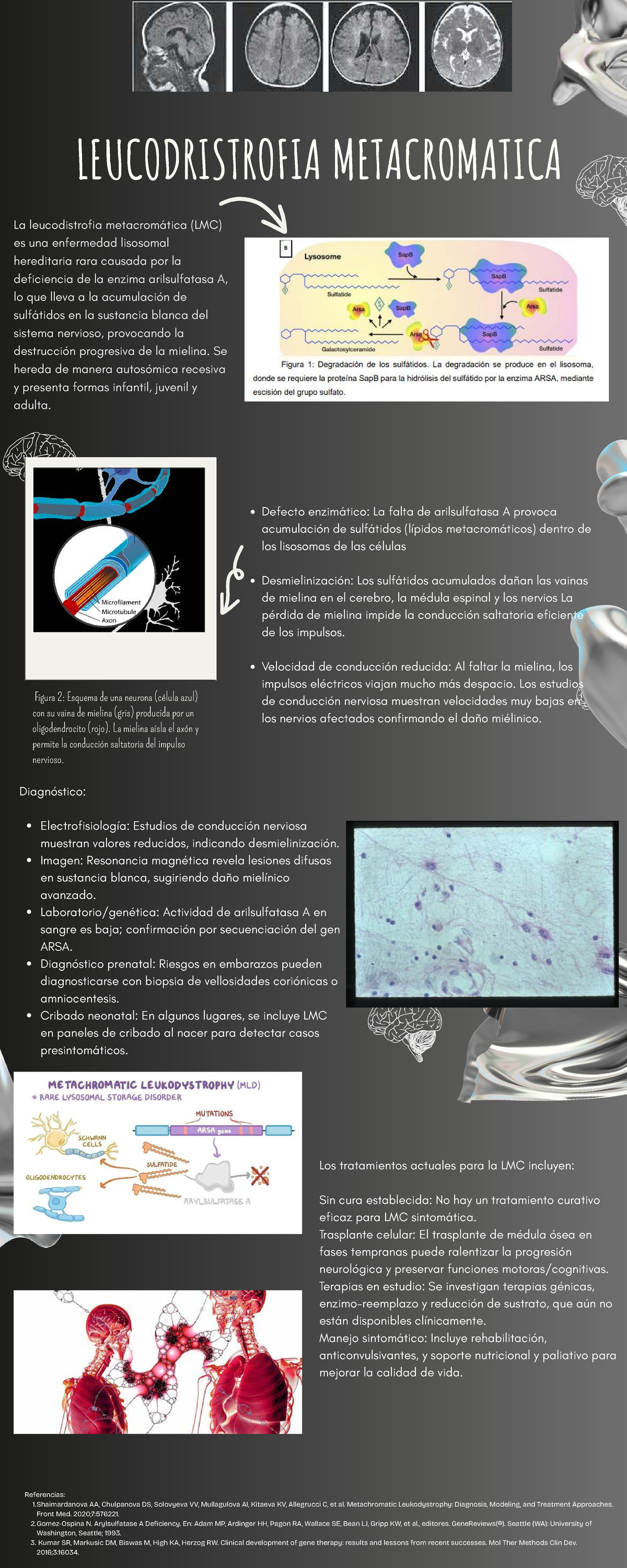 infograf-a-sobre-leucodistrofia-metacrom-tica-lmc-studocu