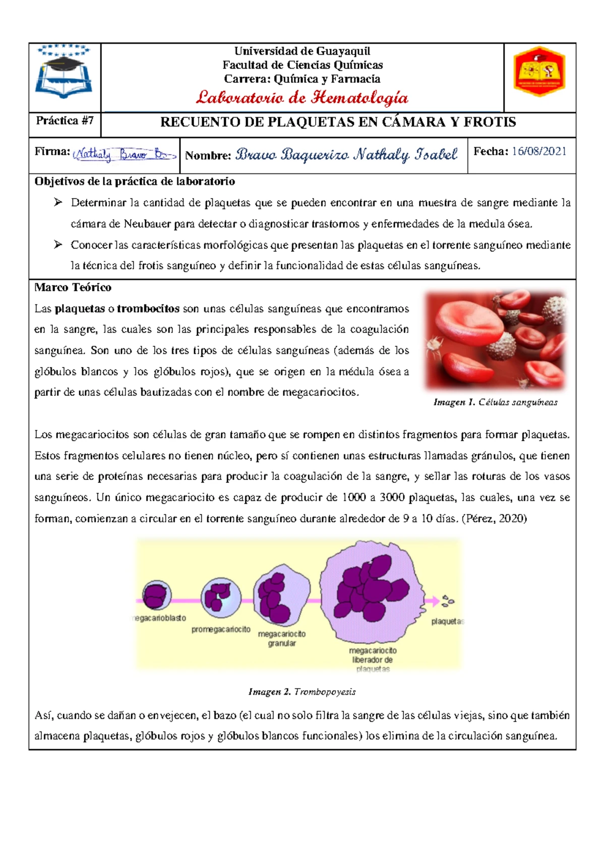 Informe #4-Morfologia de los eritrocitos Indices eritrocitarios ...