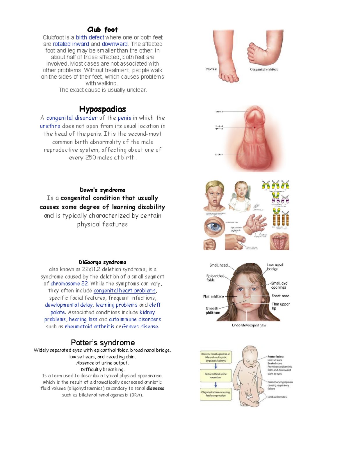 Digeorge Syndrome Feet
