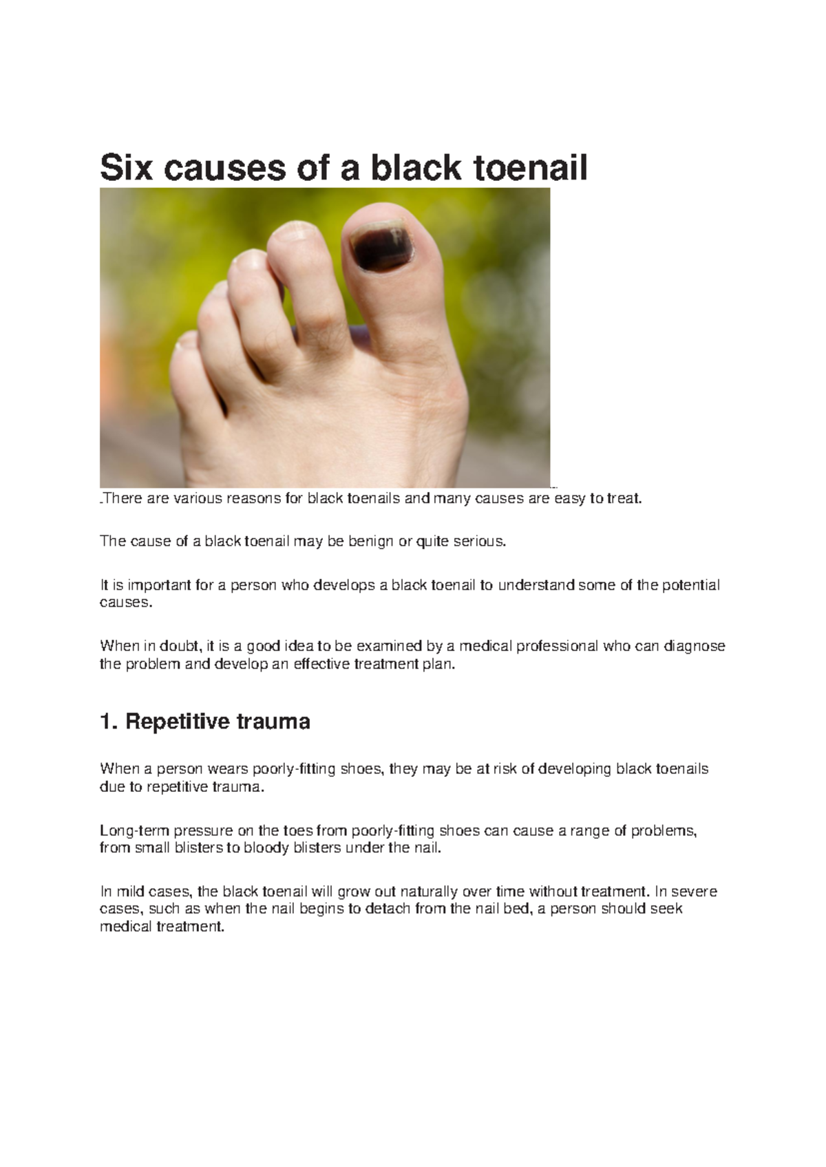 What Do Black Toes Indicate