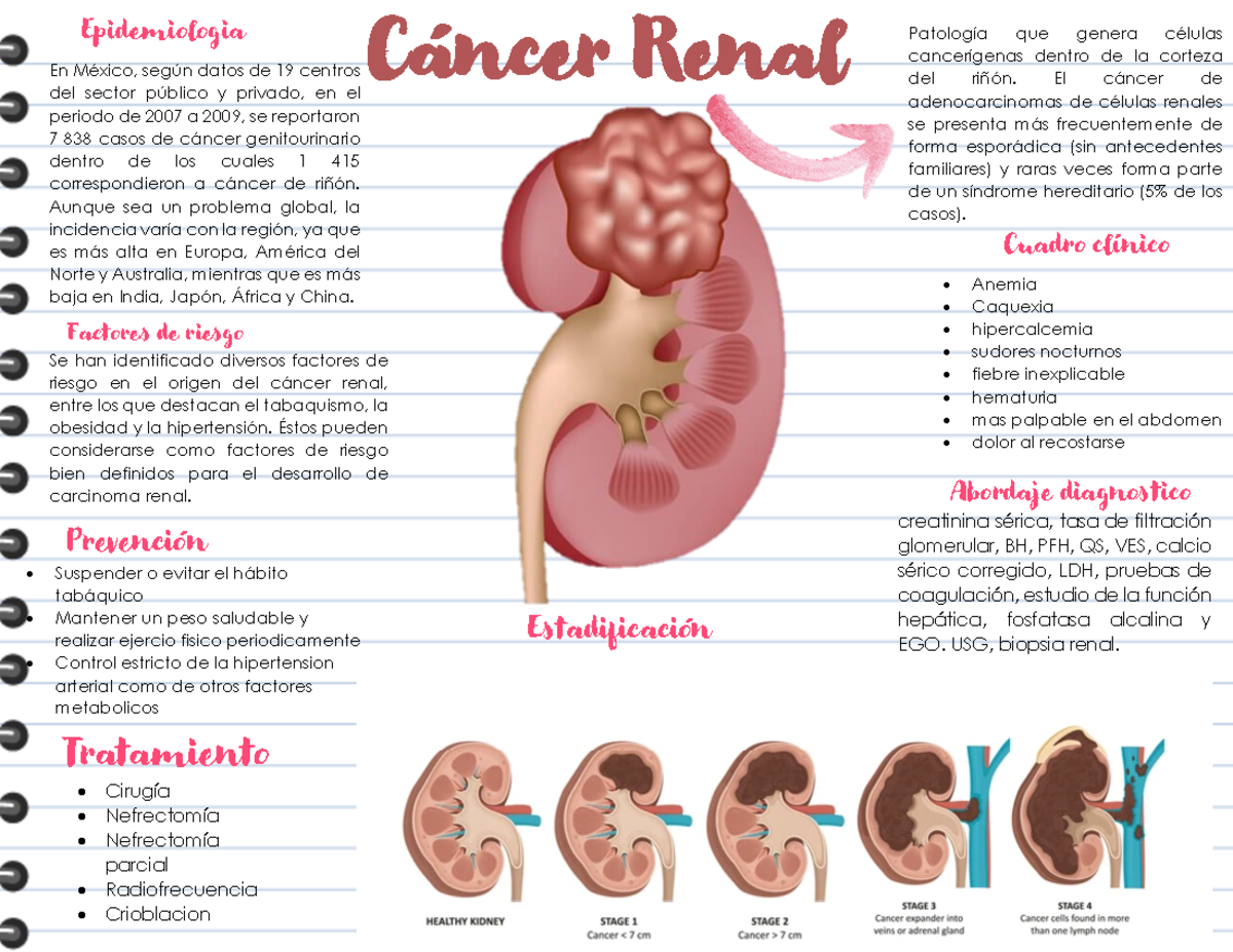 Cáncer de Riñón - Epidemiología, Tratamiento y Prevención - Studocu