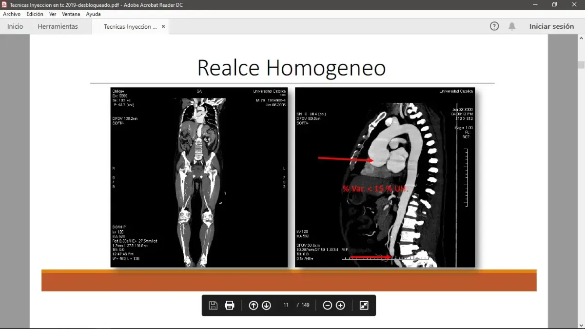 Técnicas de Inyección de Contraste IV en Tomografía Computarizada - Studocu