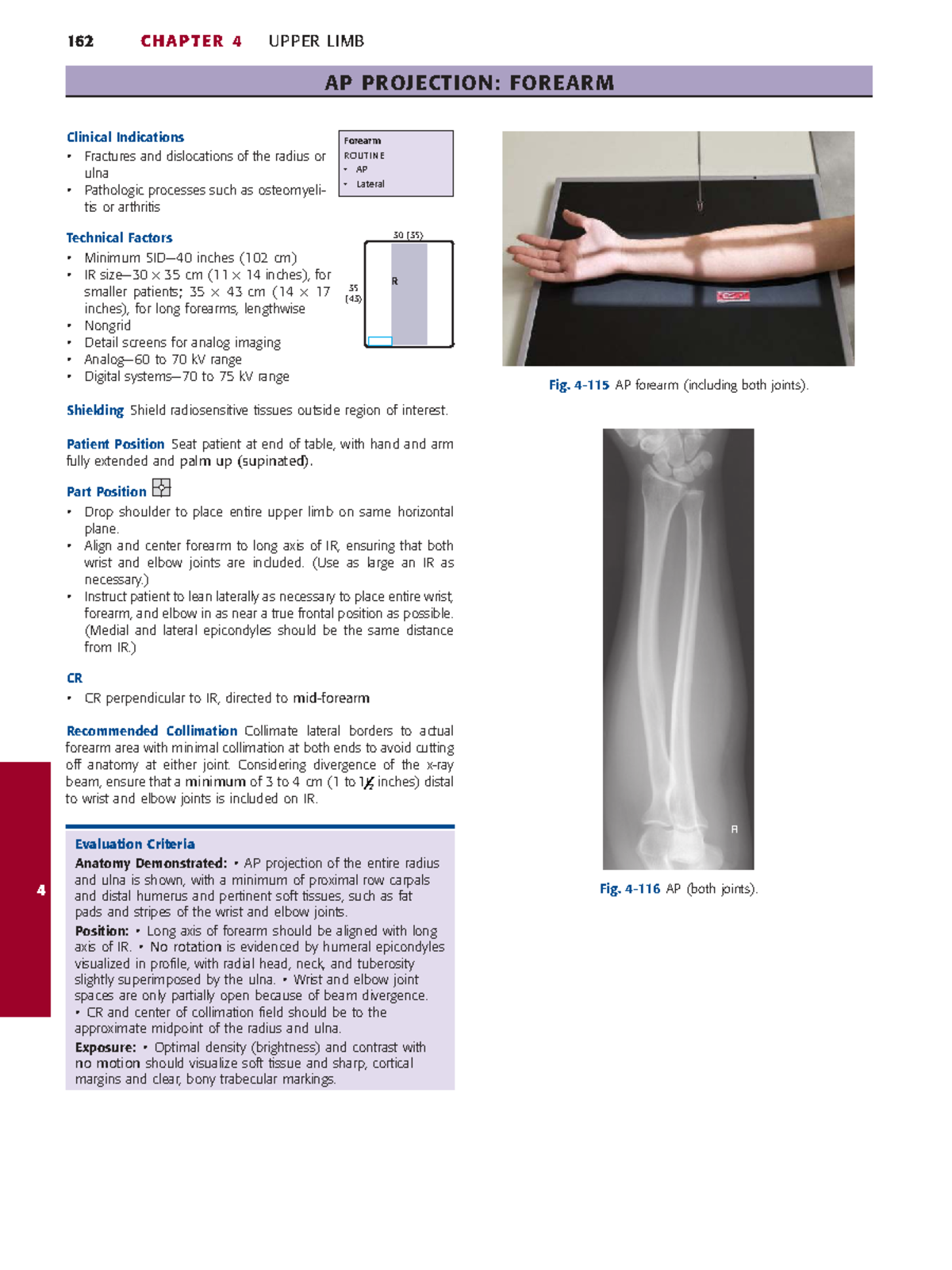 162 C CHAPTER 4: AP Forearm Projection & Clinical Indications - Studocu