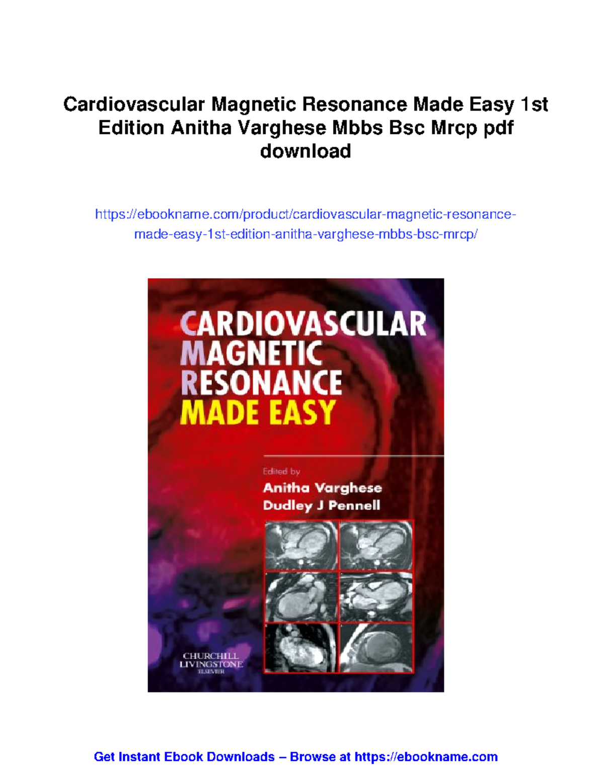 Cardiovascular Magnetic Resonance (CMR) Principles and Applications ...